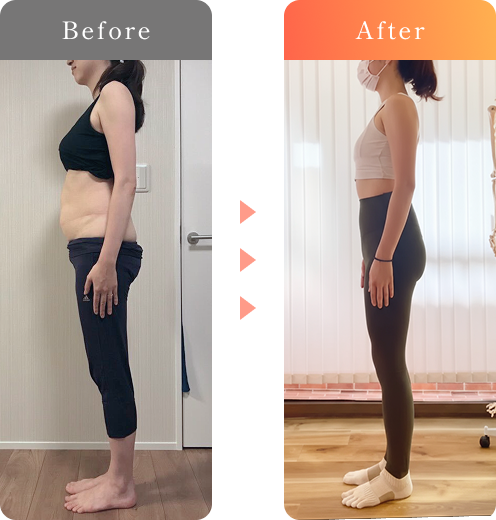 before after